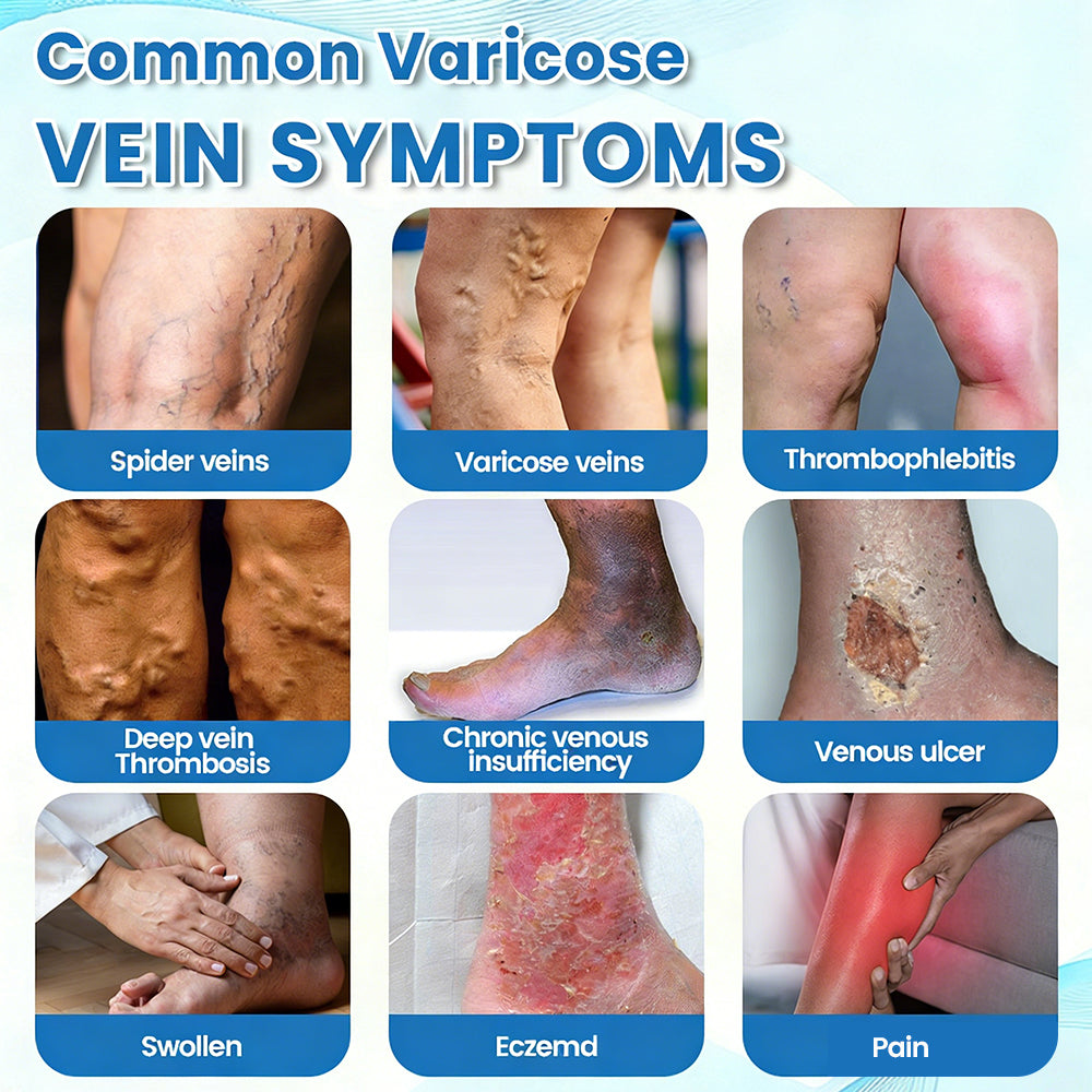 🇬🇧✅✅GFOUK® VascuCare Vein Healing Spray(Designed for Varicose veins, Spider veins, Deep vein Thrombosis, Chronic venous insufficiency, Venous ulcers, Thrombophlebitis and other venous issues)
