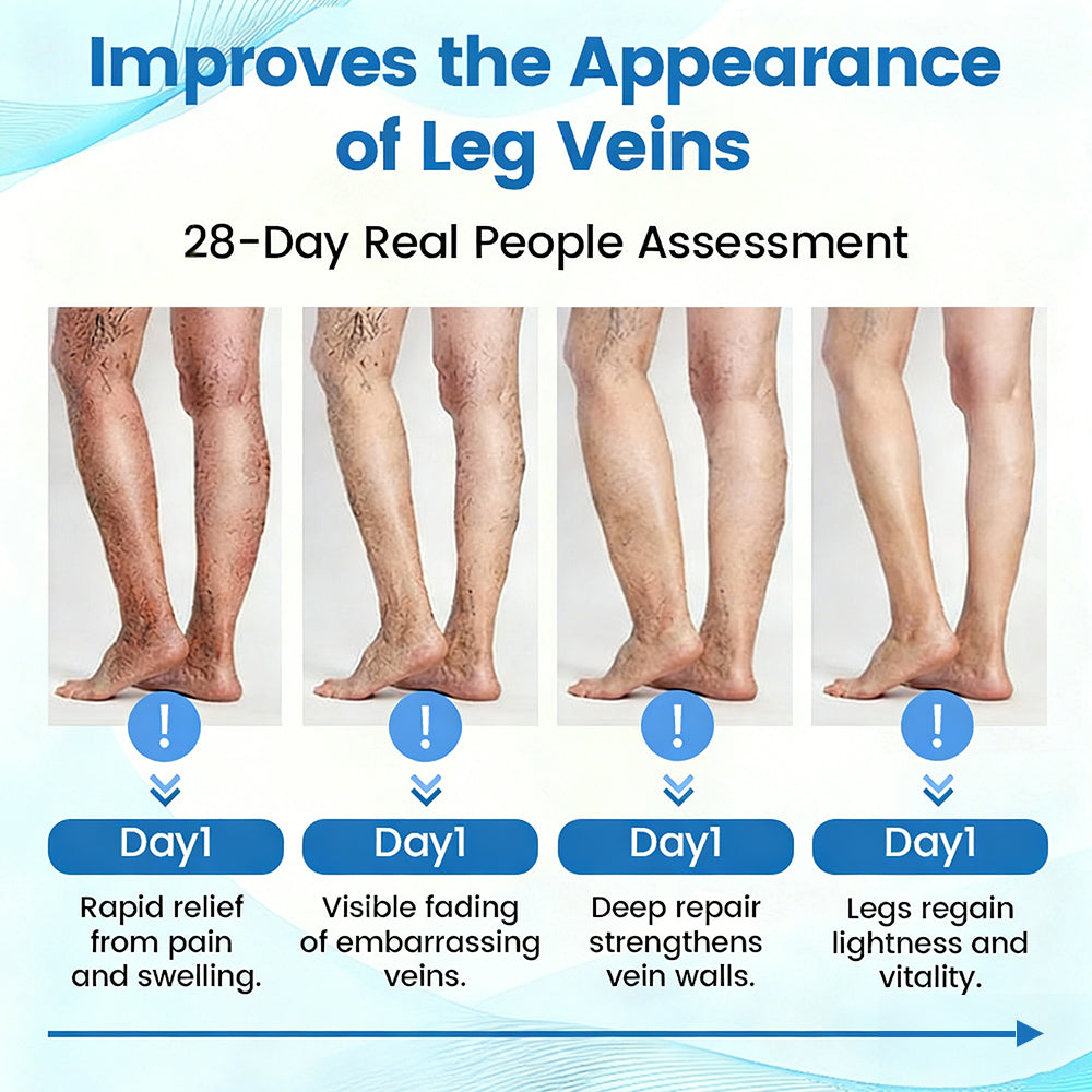 🇬🇧🎯🌿GFOUK® VascuCare Vein Healing Spray(Designed for Varicose veins, Spider veins, Deep vein Thrombosis, Chronic venous insufficiency, Venous ulcers, Thrombophlebitis and other venous issues)