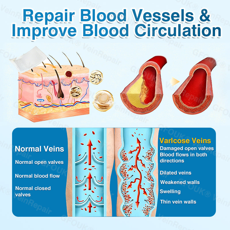 🇬🇧🏆✅️🏃GFOUK® VeinRepair Microneedle Patch Roll⚡Instant Relief, Long-Term Results