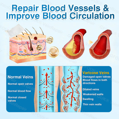 🇬🇧🏆✅️🏃GFOUK® VeinRepair Microneedle Patch Roll⚡Instant Relief, Long-Term Results