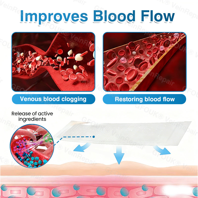 🇬🇧👨‍⚕️👨‍⚕️✅GFOUK® VeinRepair Microneedle Patch Roll⚡Instant Relief, Long-Term Results