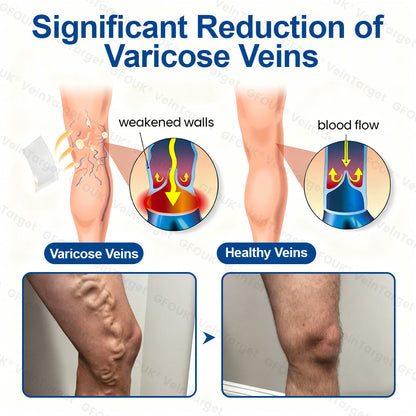 🇬🇧💙👨‍⚕️✅GFOUK® VeinTarget Microneedle Patch⚡Instant Relief, Long-Term Results