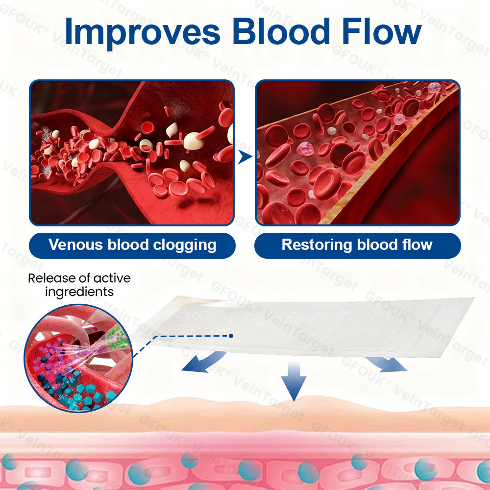 🇬🇧💙👨‍⚕️✅GFOUK® VeinTarget Microneedle Patch⚡Instant Relief, Long-Term Results