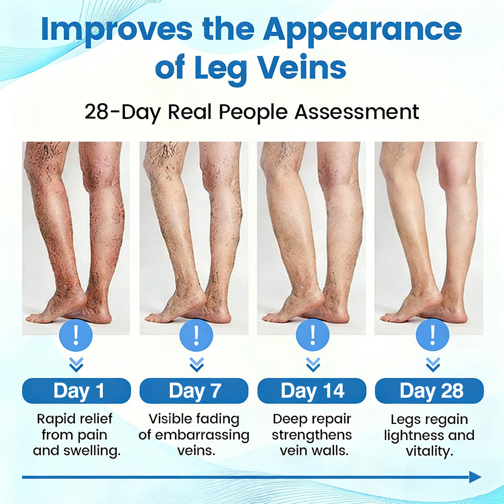 🇬🇧✅✅GFOUK® VascuCare Vein Healing Spray(Designed for Varicose veins, Spider veins, Deep vein Thrombosis, Chronic venous insufficiency, Venous ulcers, Thrombophlebitis and other venous issues)